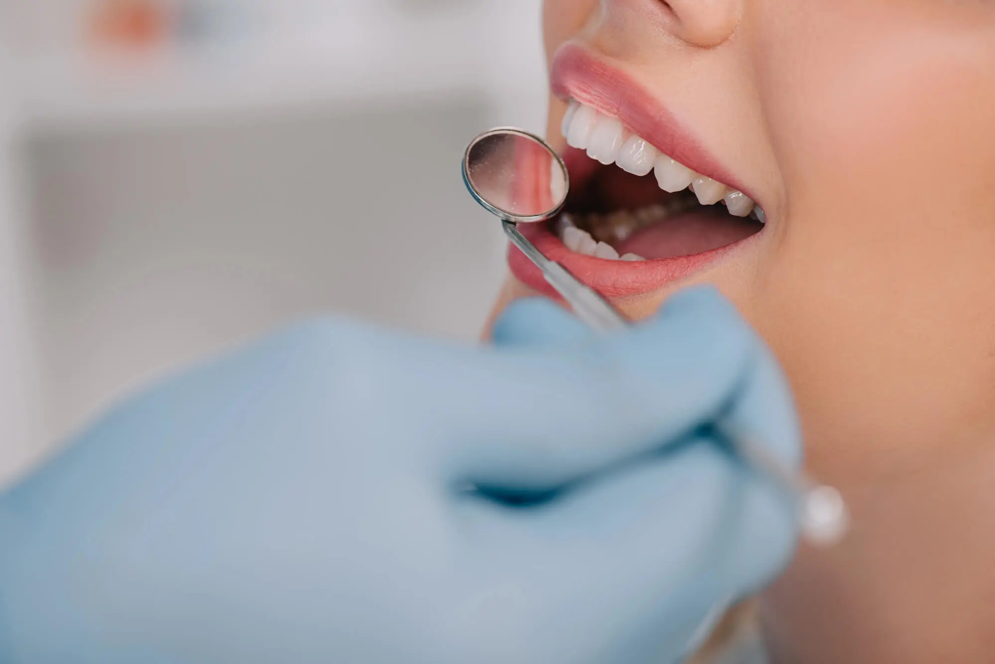 Close-up dental checkup with mirror best dentist Antioch, TN