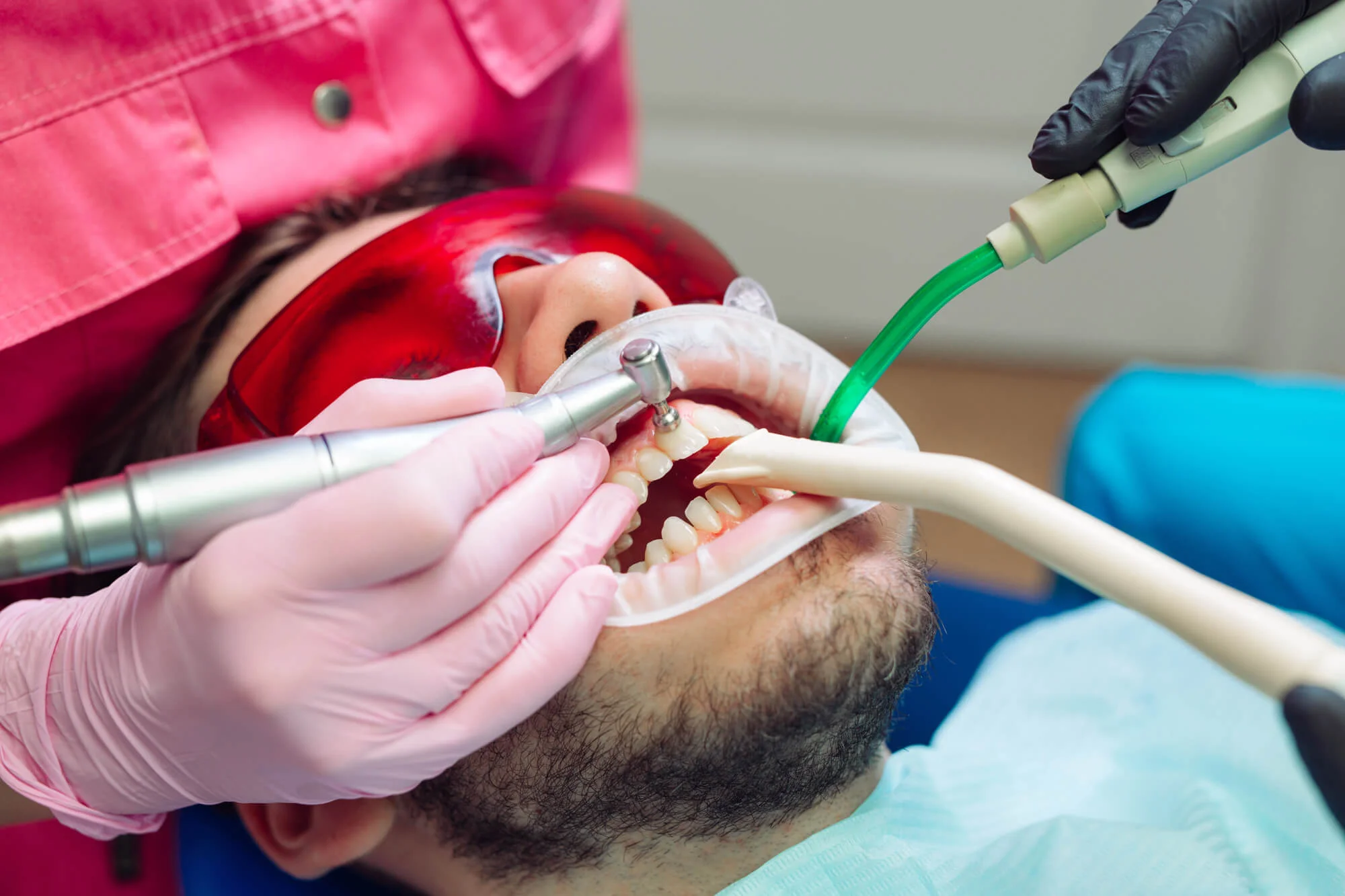 Professional dental hygienist performing teeth cleaning in Antioch